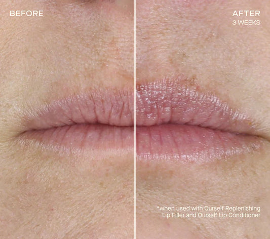 Replenishing Lip Filler