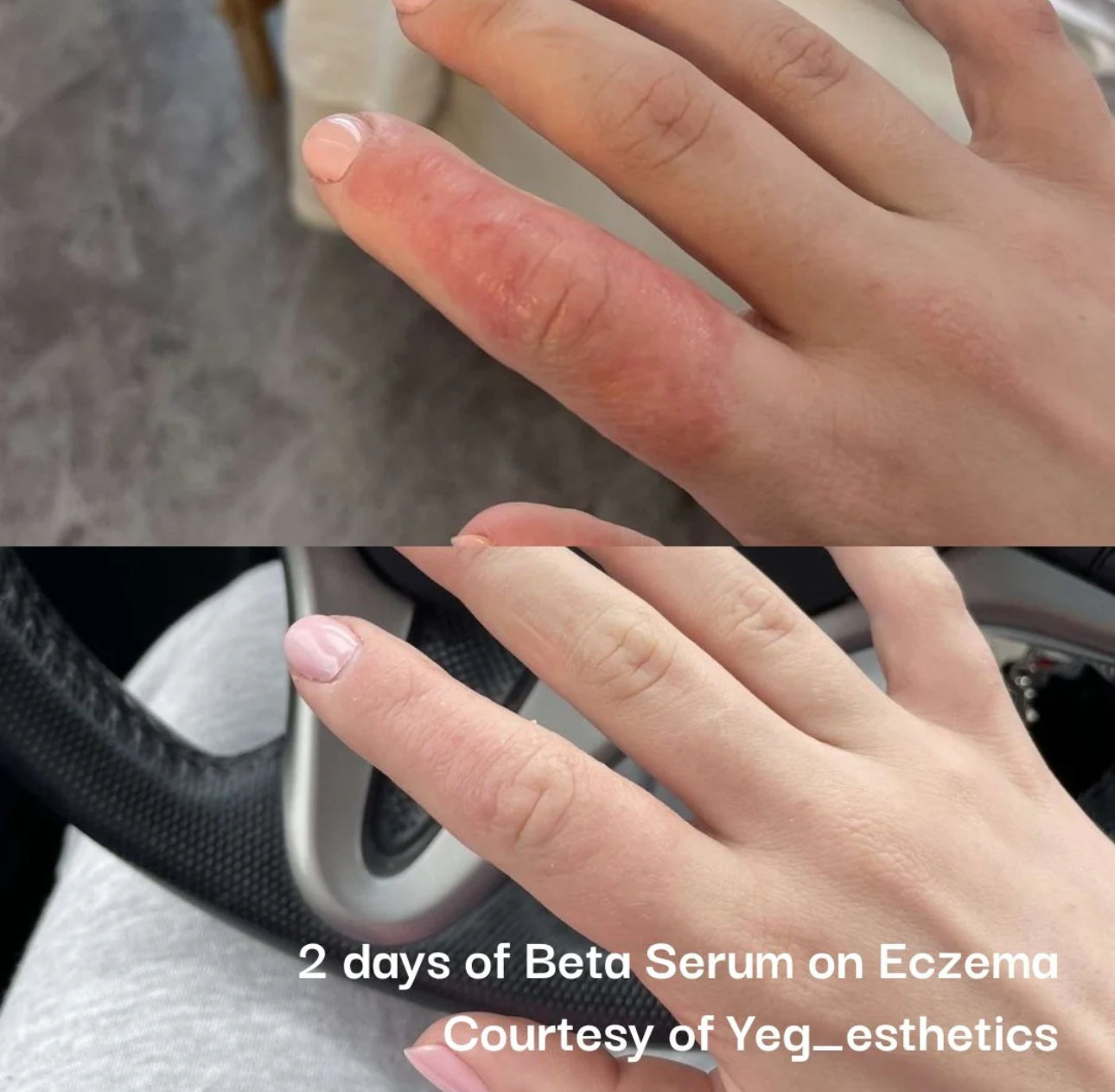 Neogensis Beta Glucan Serum