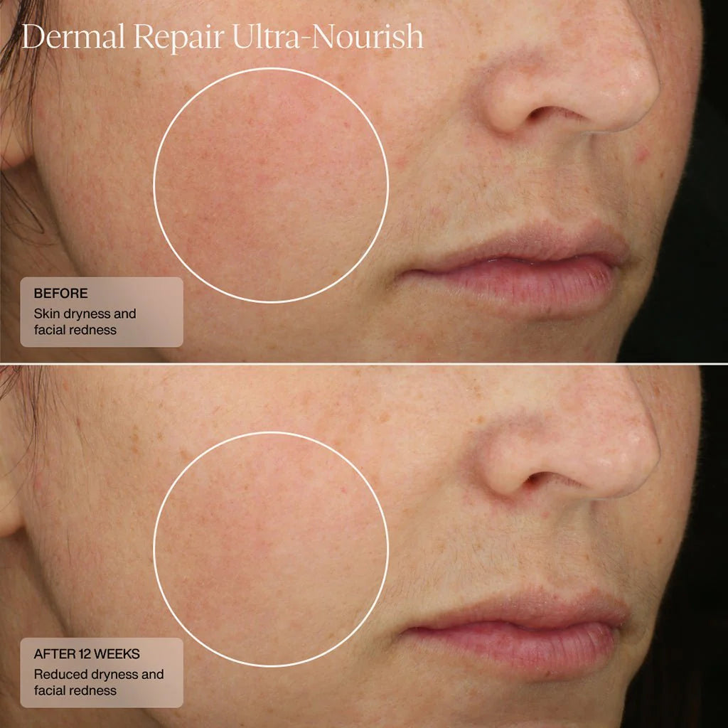 Sente Dermal Repair Ultra Nourish