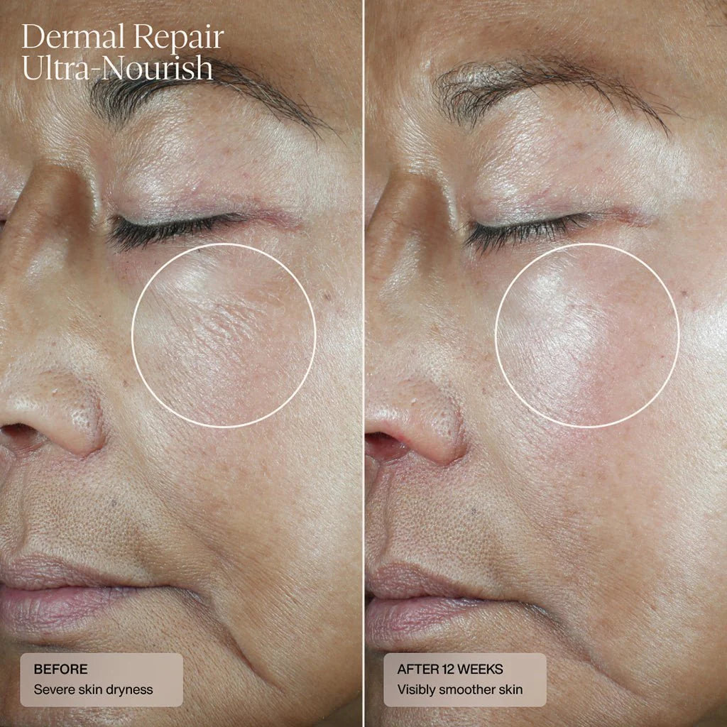 Sente Dermal Repair Ultra Nourish