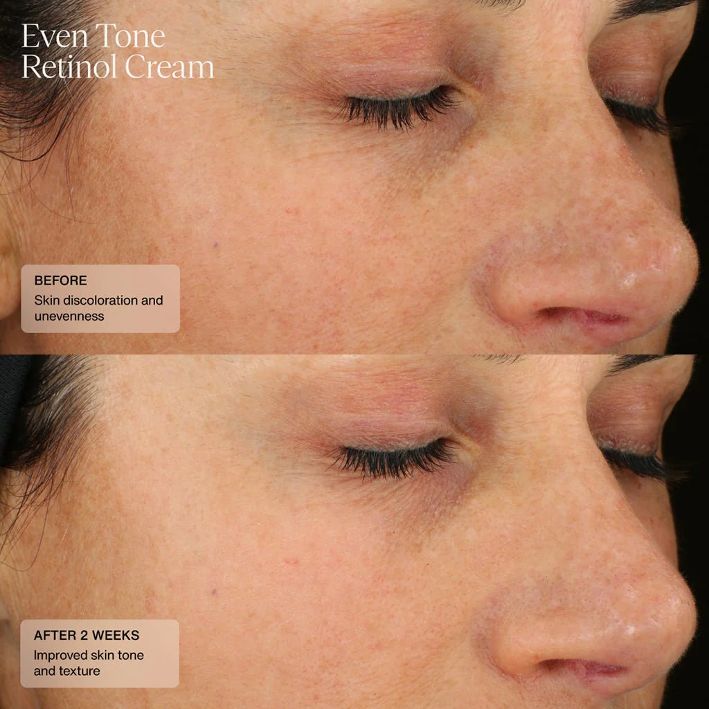 Sente Even Tone Retinol Cream