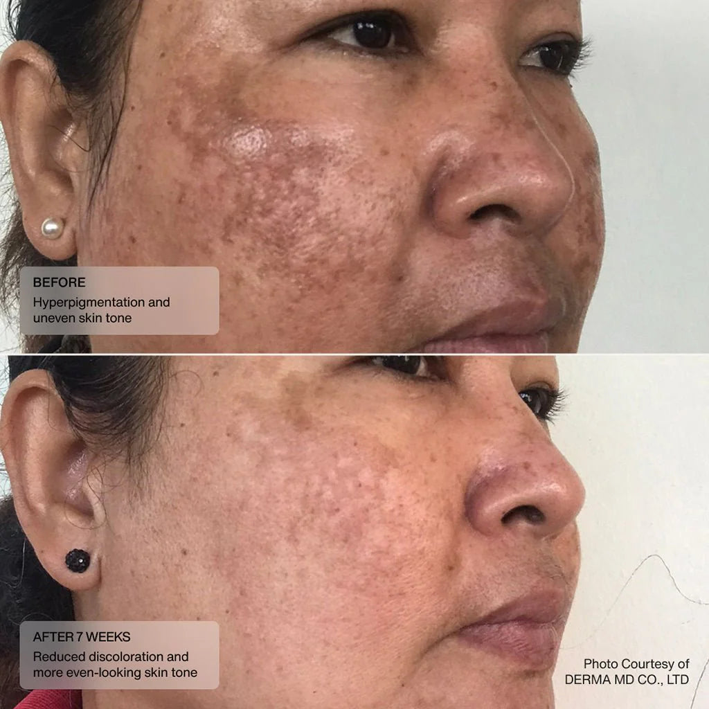 Sente Even Tone Retinol Cream