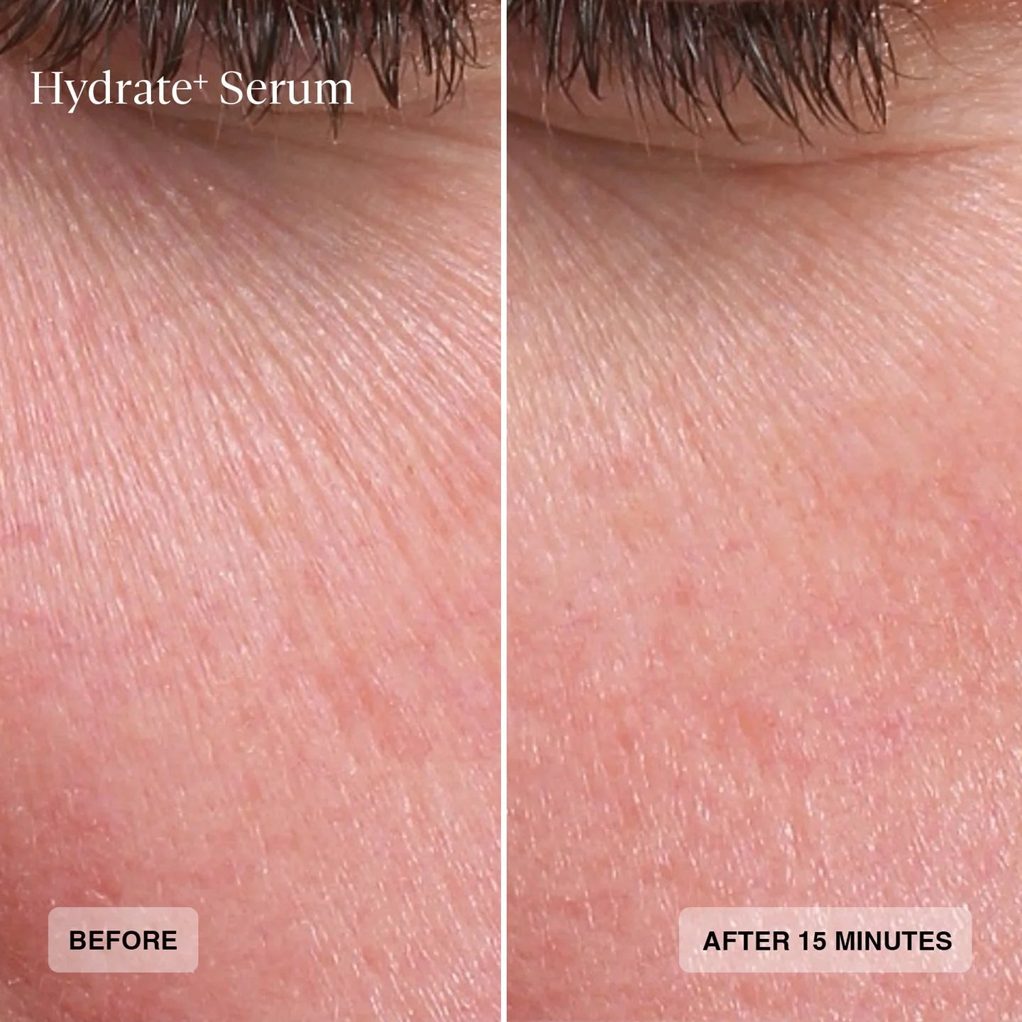 Sente Hydrate+