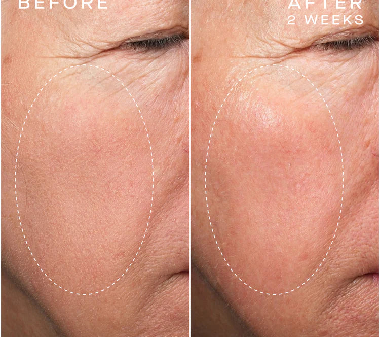 Advanced Regenerative Serum