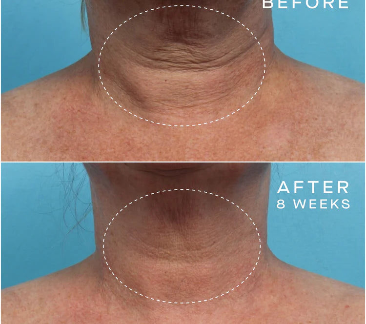 Advanced Regenerative Serum